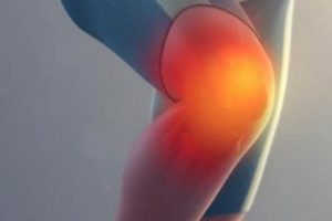 Zumba Knee Pain Relief: Causes & Recovery Class Tips The Ultimate Zumba Guide: Dance Your Way to a Healthier You Zumba Knee Pain Relief: Causes & Recovery Class Tips | The Ultimate Zumba Guide: Dance Your Way to a Healthier You