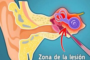 Why "Porque Te Zumba El Oido"? Causes & Relief Safem Fabrication - Precision Engineering & Custom Manufacturing Solutions Why "Porque Te Zumba El Oido"? Causes & Relief | Safem Fabrication - Precision Engineering & Custom Manufacturing Solutions