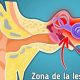 What Makes XQ Zumba El Oido Ring? Causes & Relief | The Ultimate Zumba Guide: Dance Your Way to a Healthier You