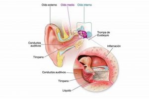 Por qu zumba el oido de repente? Causes & Relief The Ultimate Zumba Guide: Dance Your Way to a Healthier You Por qu zumba el oido de repente? Causes & Relief | The Ultimate Zumba Guide: Dance Your Way to a Healthier You